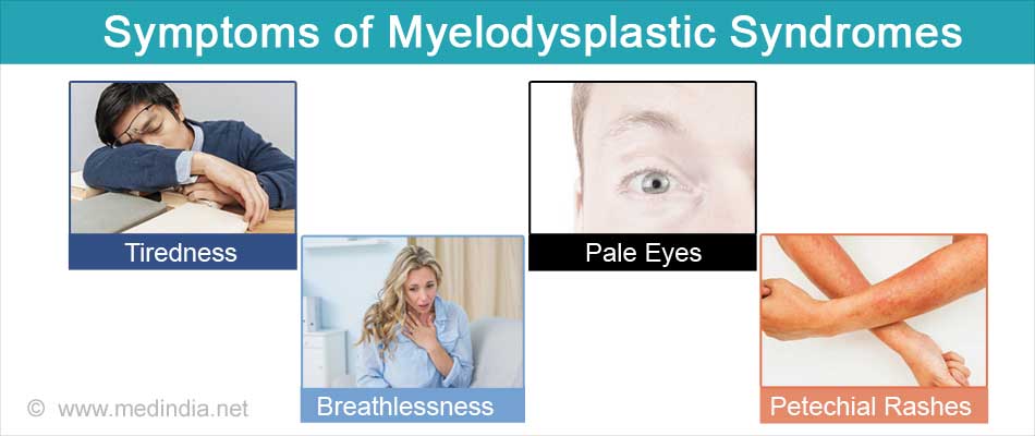 Myelodysplastic Syndrome - Types, Causes, Symptoms, Diagnosis ...