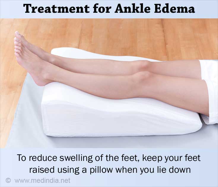 Treatment for Ankle Edema 