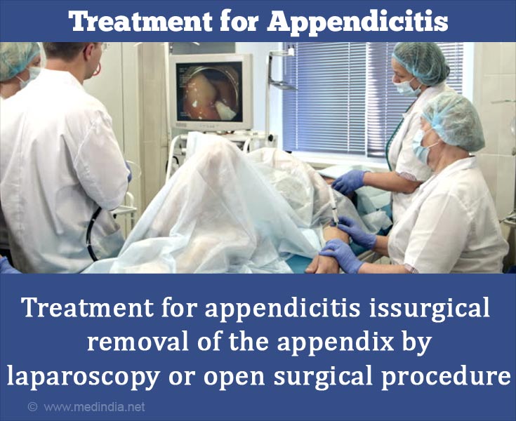 Treatment For Appendicitis