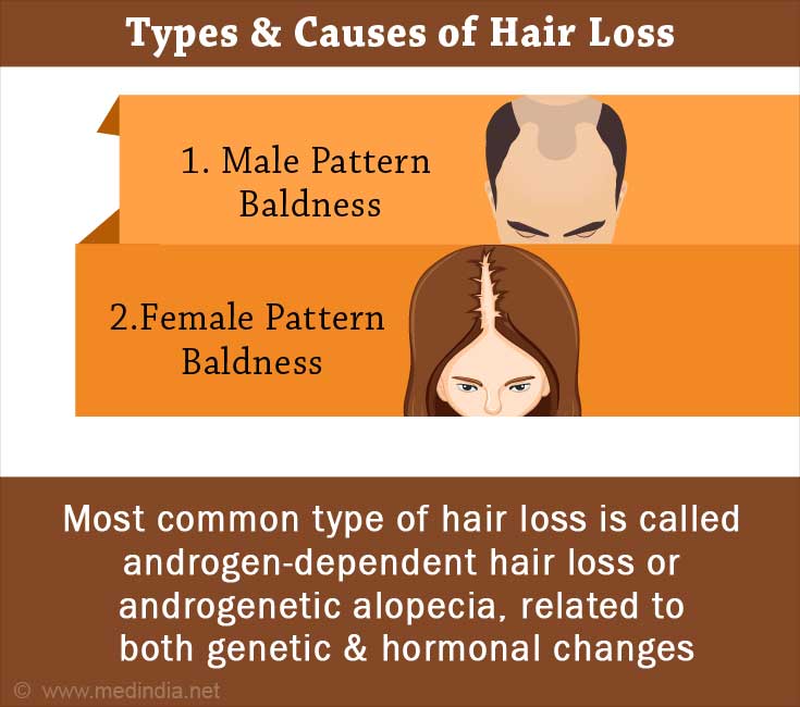 Hair Loss - Types and Treatments