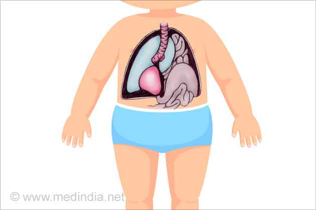 Diaphragmatic Hernia