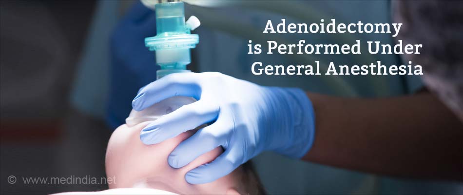 Adenoidectomy is Performed Under General Anesthesia