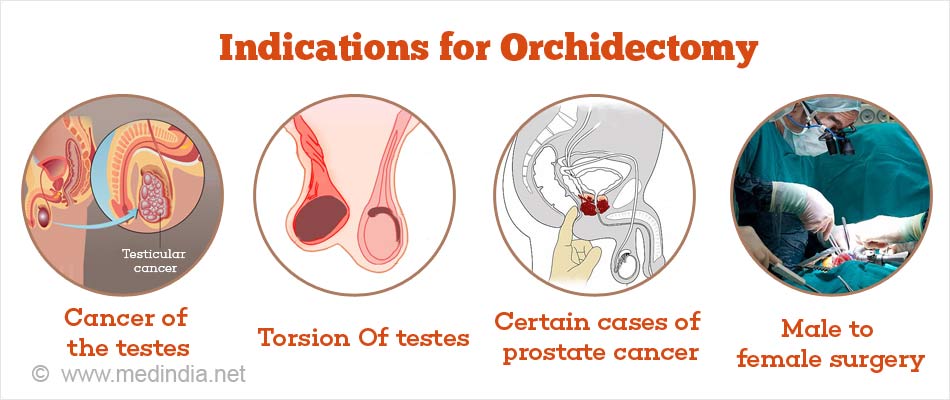 Orchiectomy