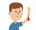 Quiz on Bleeding Disorders