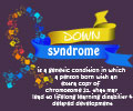 Down Syndrome - Infographic