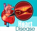 Heart Disease - Infographic