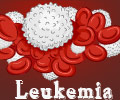 Leukemia - Infographic