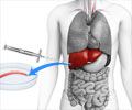 Liver Biopsy