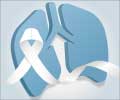 World Lung Cancer Day: It's Time to Raise Awareness