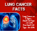 Lung Cancer - Infographics