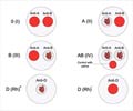 Test Your Knowledge on Blood Groups