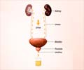 Quiz on Blood in Urine (Hematuria)