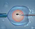 Quiz on Invitro Fertilization