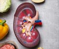 Quiz on Kidney Failure Diet