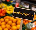 Quiz on Malnutrition