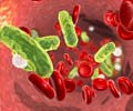 Test Your Knowledge on Sepsis