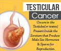 Testicular Cancer - Infographics