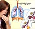 Hemoptysis Symptom Evaluation