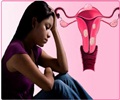 Menorrhagia - Support Groups