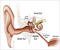 Presbycusis