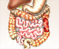 Stomach Tuberculosis