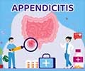 Know your Appendix Friendly Diet