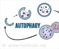 Autophagy: Self-Repair Mechanism at Cellular Level