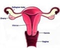 Endometrial Cancer - Support Groups