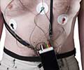 Holter Monitoring - Tests, Procedures and Results