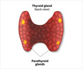 Hyperparathyroidism