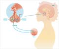 Hyperprolactinemia