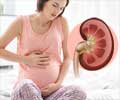 Kidney Stones during Pregnancy