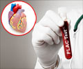 PLAC Test for Cardiovascular Disease