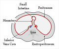 Retroperitoneal Fibrosis / Ormonds Disease