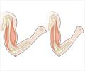 Sarcopenia