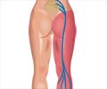 Sciatica Exercises: Stretches for Pain Relief