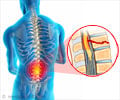 Spinal Injury - Symptom Evaluation