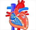 Wolff-Parkinson-White Syndrome (WPW)