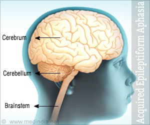 Acquired Epileptiform Aphasia Landau Kleffner Syndrome - 