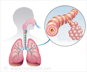 bronchitis and azithromycin 250 mg