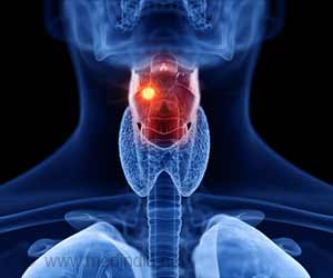 Symptoms Of Cancer Of Larynx Or Throat Cancer Or Laryngeal Cancer