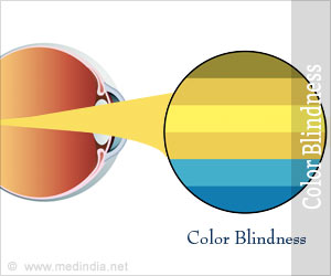 Diabetic Retinopathy - Risk Factors - Symptoms - Treatment - Diagnosis ...