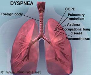 Dyspnea (Shortness of Breath): Causes, Symptoms & Treatment