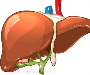 Gallbladder Cancer - Types, Causes, Symptoms, Diagnosis, Treatment 