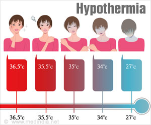 Hypothermia - Causes, Risk Factors, Symptoms, Diagnosis, Treatment ...