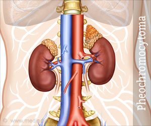 disorder of the adrenal glands