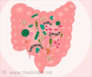 large intestine bacterial overgrowth
