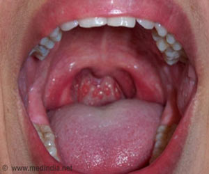 Drainage In The Throat 52