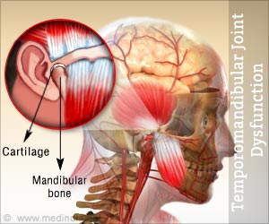 List of drugs used for Temporomandibular Joint Dysfunction ...