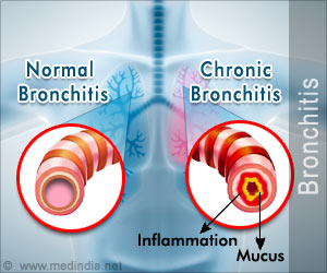Quiz on Bronchitis